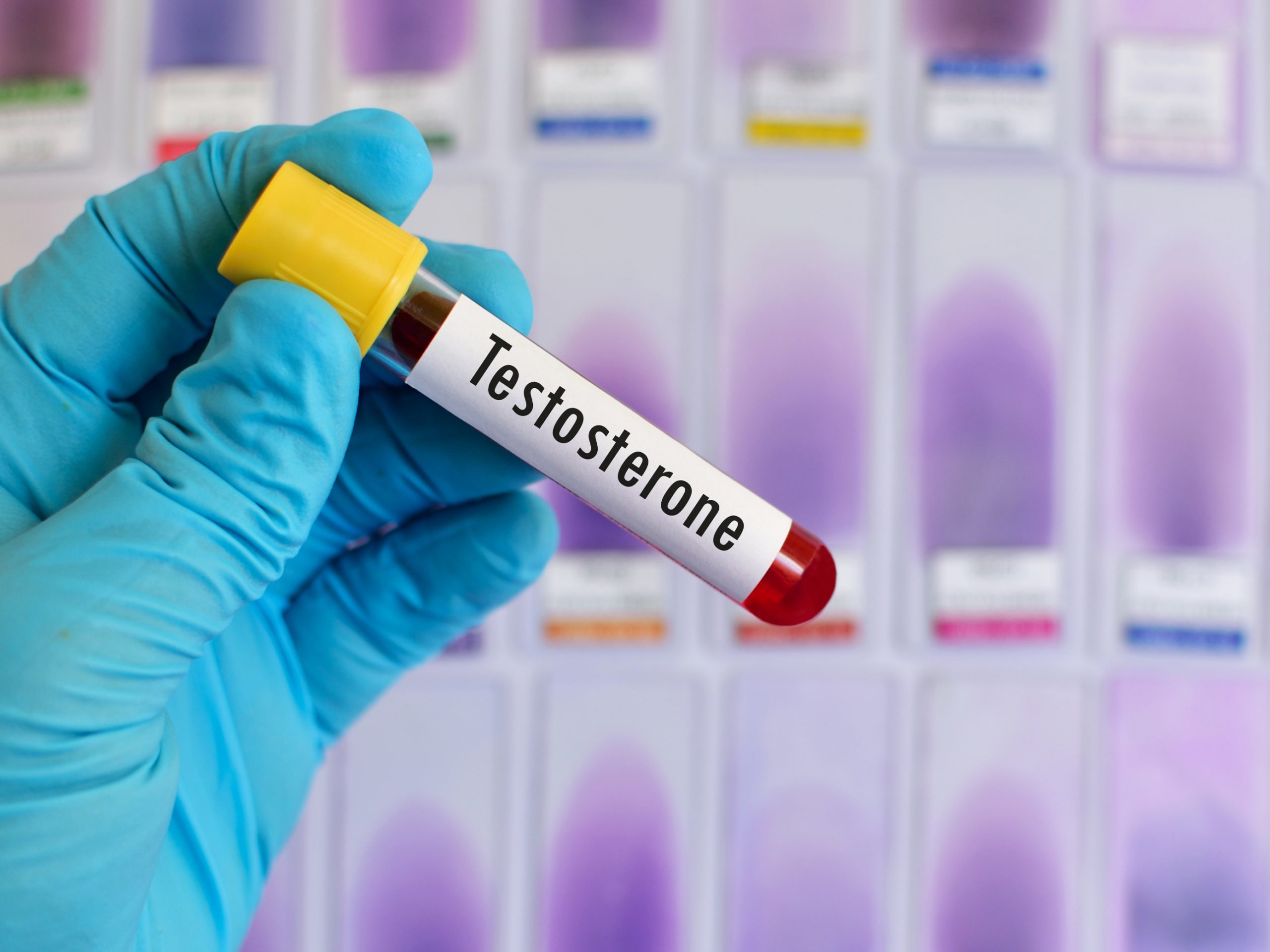 Low Testosterone Health Risks